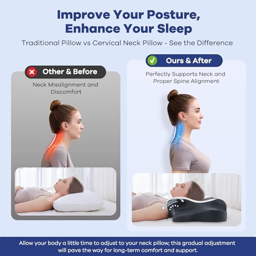 DONAMA Cervical Neck Pillow for Pain Relief, Cervical Pillow with Memory Foam Ergonomic Pillows with Dual Heights for Back, Stomach and Side Sleepers Kids' Floor Pillows Cushions