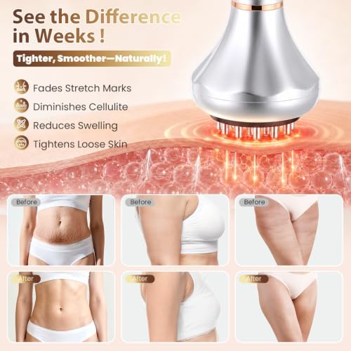 Lymphatic Drainage Massager & Anti-Cellulite Massage Tool, Body Sculpting Device for Legs, Arms, Stomach & Hips Promotes Smoother, Firmer-Looking Skin, with Gentle Warming & Soothing Vibration ,Silver