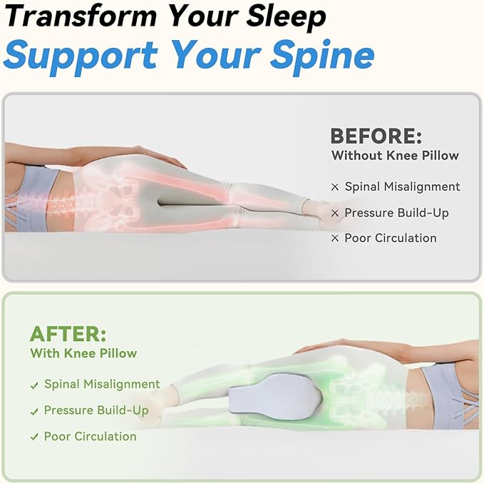 UJPFEO Knee Pillow for Side Sleepers,Leg Pillows for Sciatica,Knees,HIPS,Joints Between Legs,Back Pain Relief When Side Sleeping Spine Alignment Support for Knee Surgery Recovery,Grey
