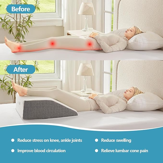 Nordjager Leg Pillow for Elevation & Support, 24"x22"x8" Memory Foam Cushion with Grey White Patterned Polyester Cover, Ideal for Improving Circulation & Relaxing Leg